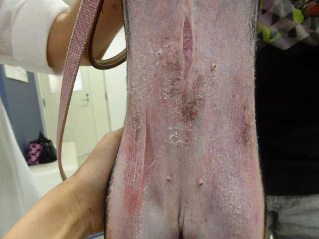 腹部