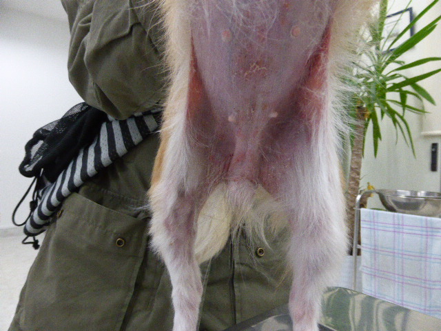 腹部