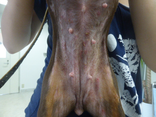 腹部