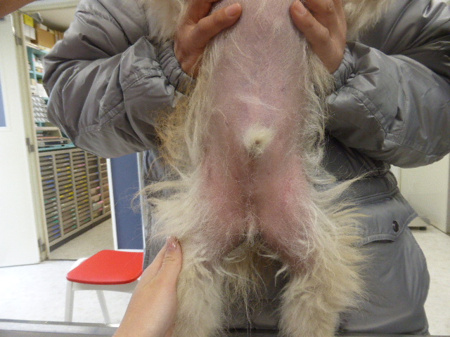 腹部